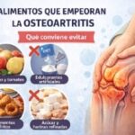 Alimentos que empeoran la osteoartritis
