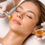 Efectos secundarios del peeling químico efectos secundarios peeling quimico