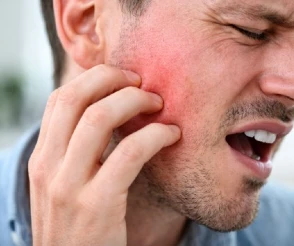 Alergia al Anisakis del pescado