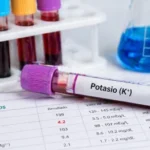 Valores normales de potasio y qué significa Potasio valores normales