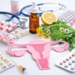 Tratamientos para endometriosis