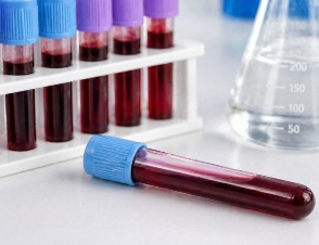 Valores normales de sodio y qué significa