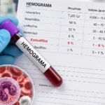 Eosinófilos valores altos o bajos