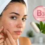Niacina o vitamina B3 para piel grasa y acné