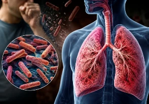 ¿Qué es la tuberculosis y cómo se contagia?