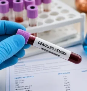 Ceruloplasmina alta o baja: qué significa