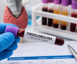 Tiroglobulina alta o baja: qué significa