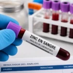Zinc bajo en sangre: síntomas y causas Zinc en sangre