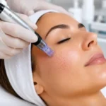 Dermapen para que rive