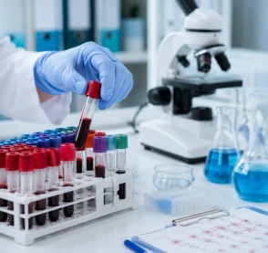 ¿Qué análisis de sangre indican que el hígado está mal?