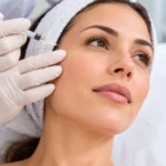 Mesoterapia facial: qué es, resultados y cuántas sesiones se necesitan Mesoterapia para rostro